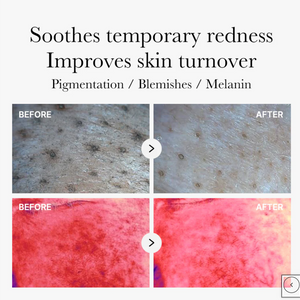 [MEDICUBE] Red Succinic Acid Panthenol Pads